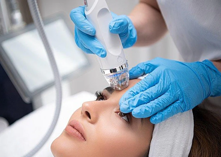 RF & RF Microneedling
